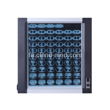 حرفه ای پزشکی Led Film Viewer X-Ray View Box